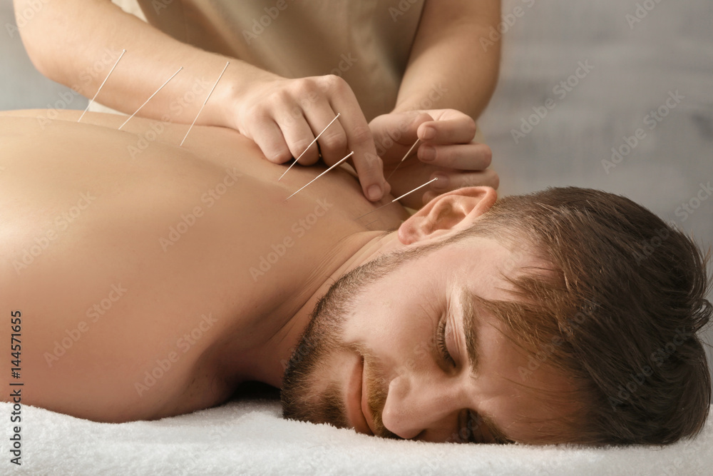 Get Motor Point Acupuncture In San Francisco