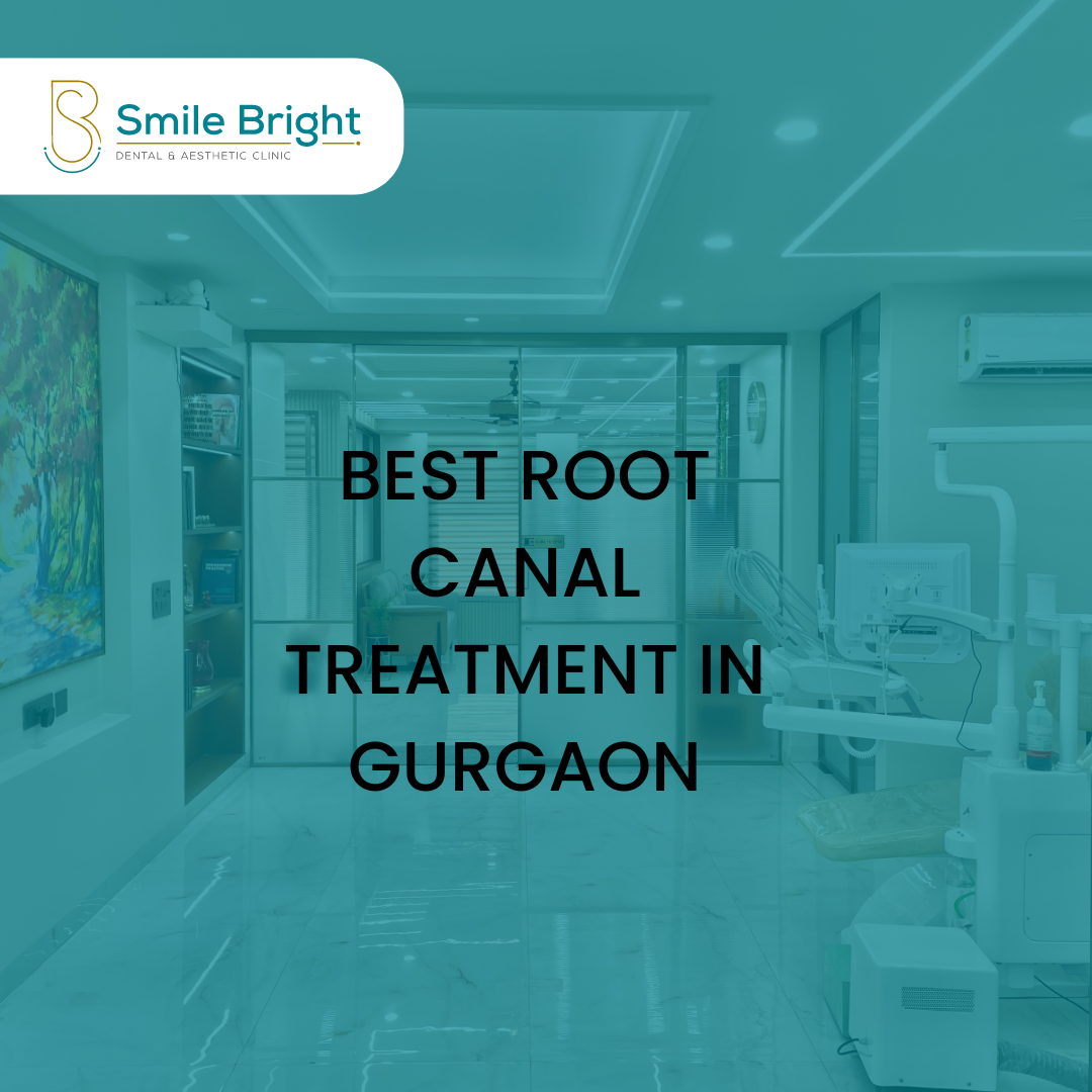 Best Root Canal Treatment In Gurgaon