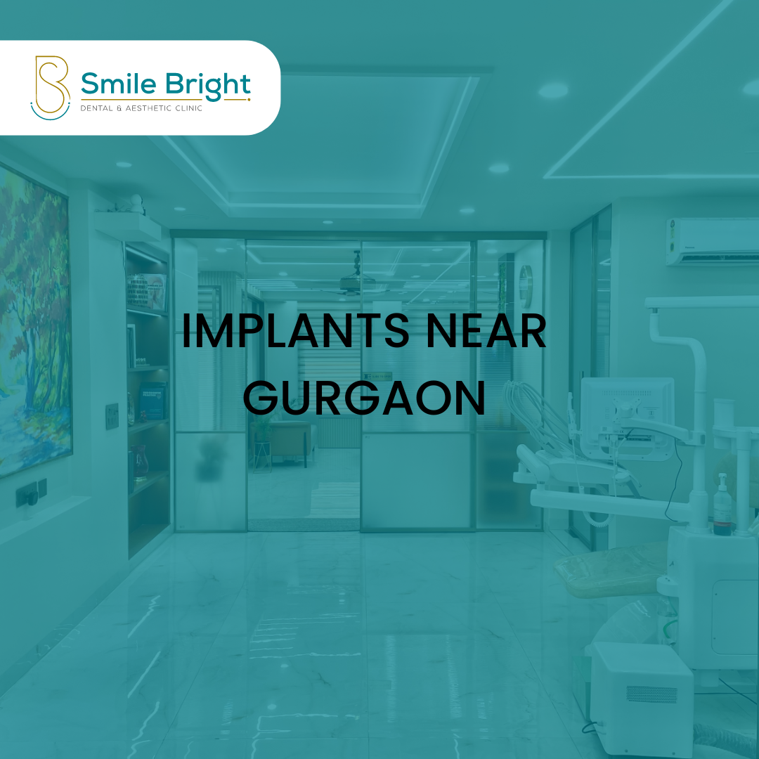 Implants Near Gurgaon