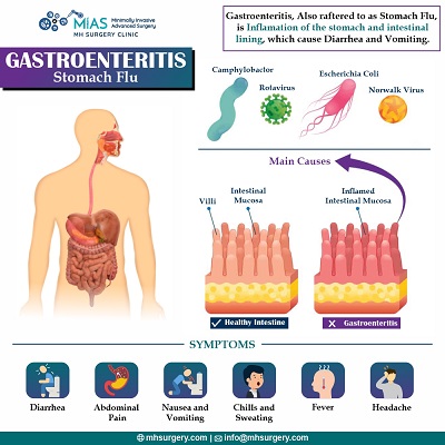 Best Surgical Gastro Surgeon (Gastroenterologist) In Bangalore