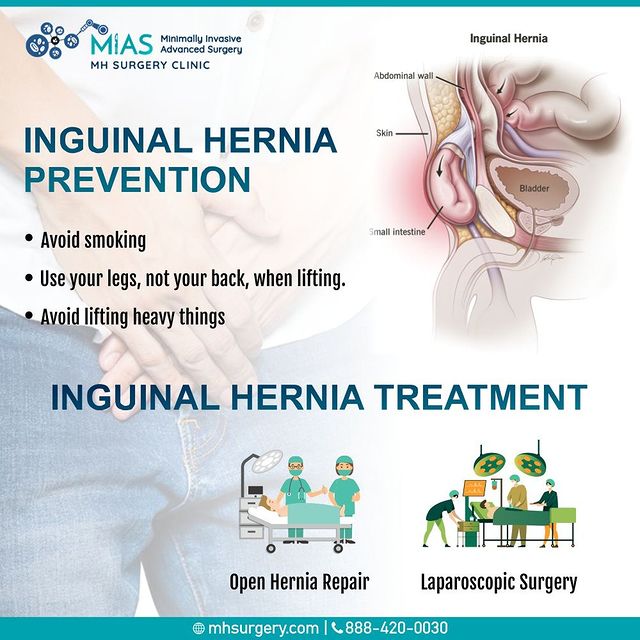 Mh Surgery Clinic: Best Surgery Hospital In Bangalore
