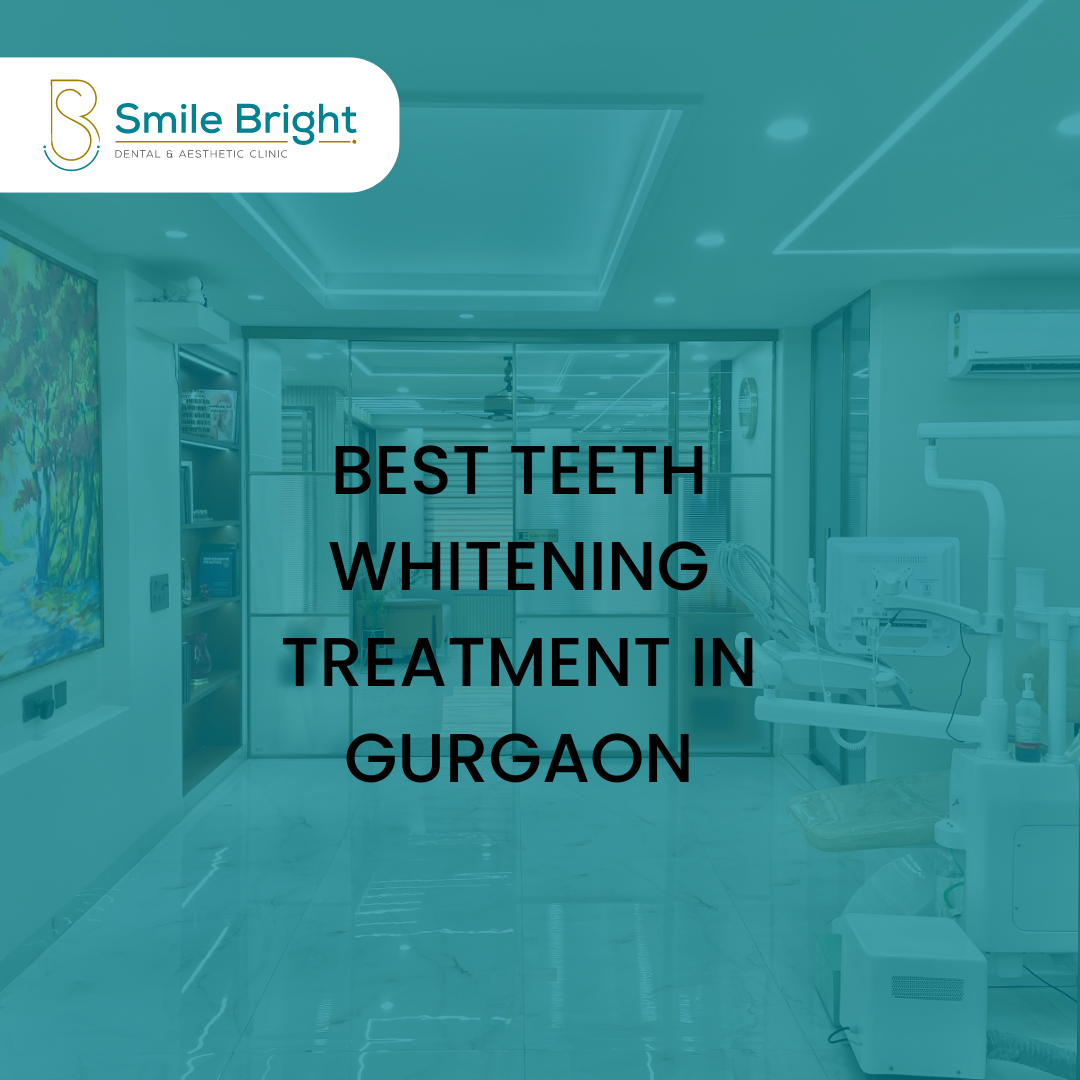 Best Teeth Whitening Treatment In Gurgaon