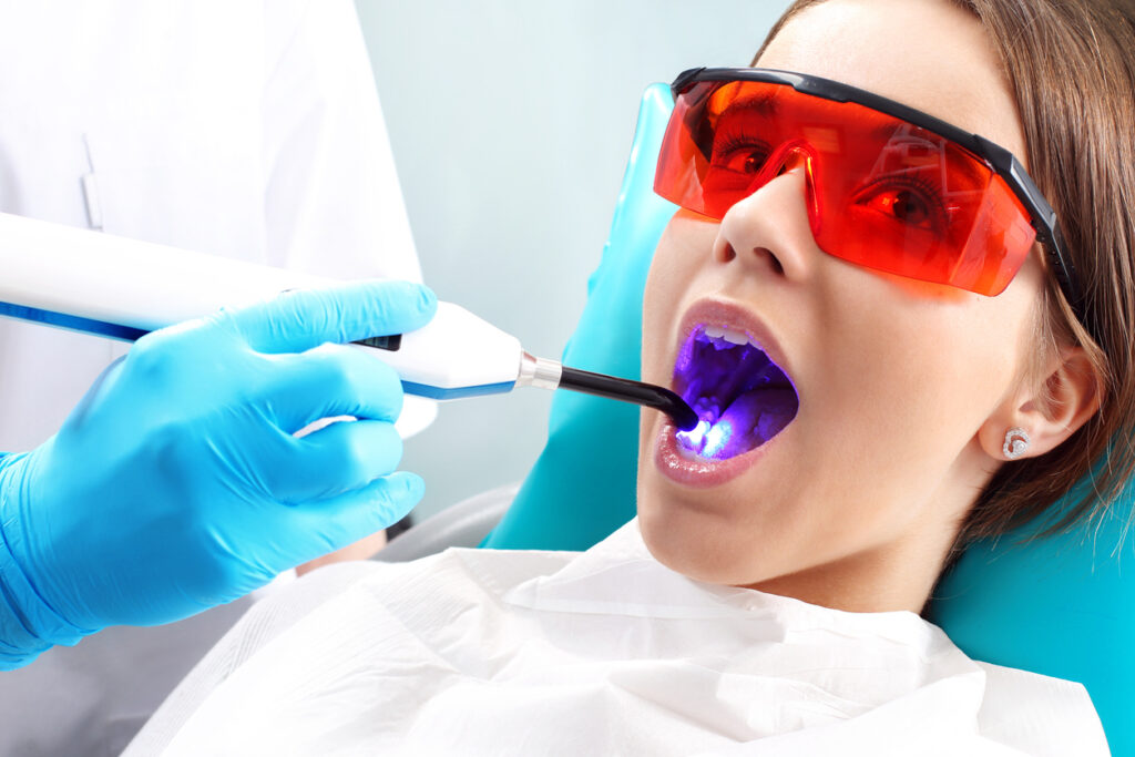 Dental Sealants In Artesia, Ca