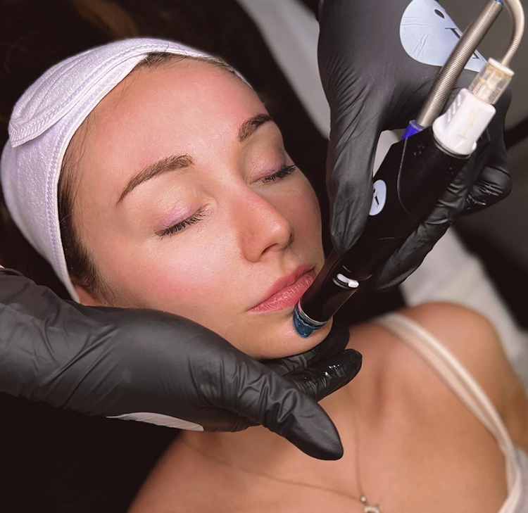 Expert And Safe Laser Hair Removal London, Ontario
