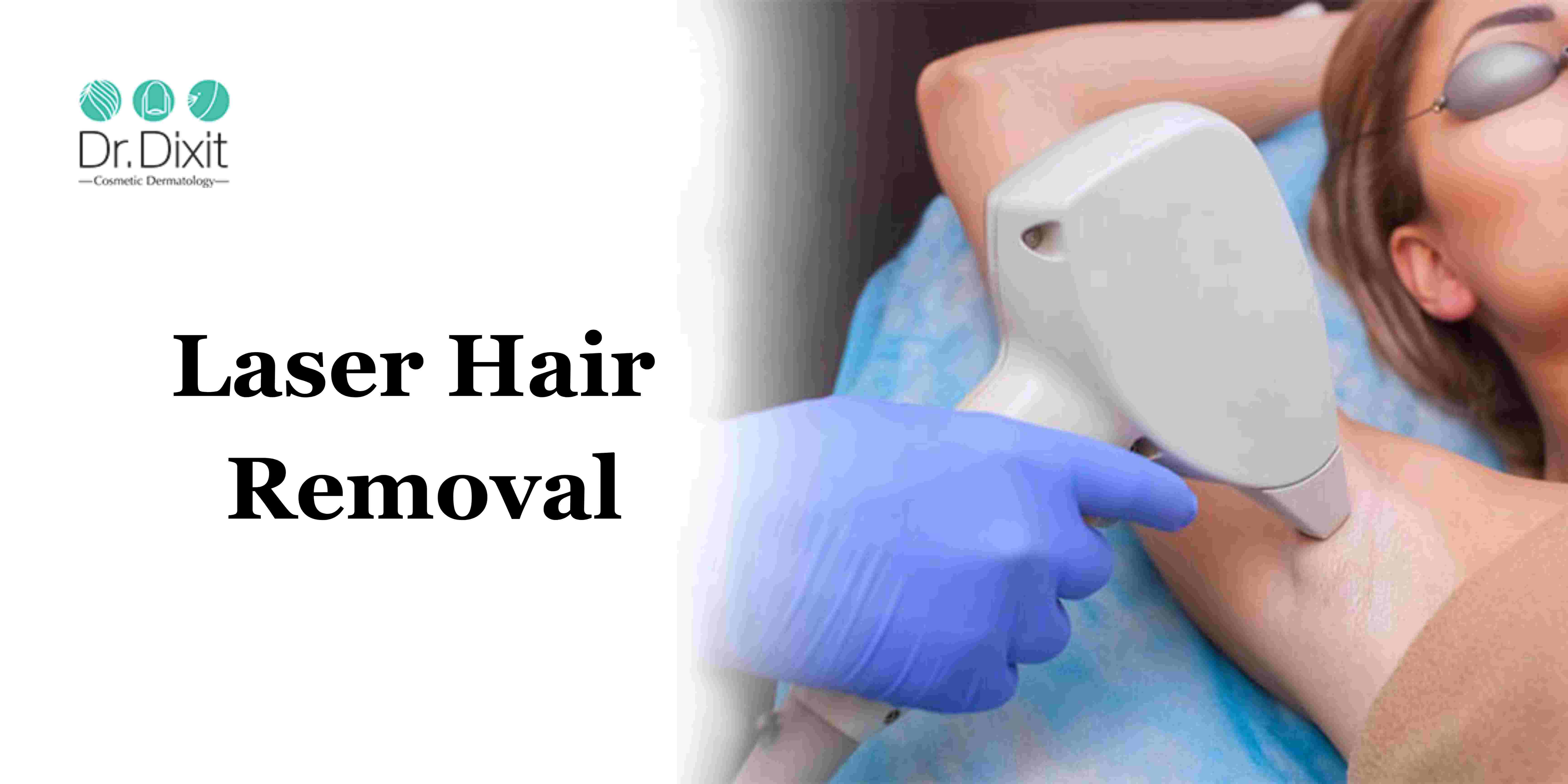 Affordable  Laser Hair Removal In Bangalore