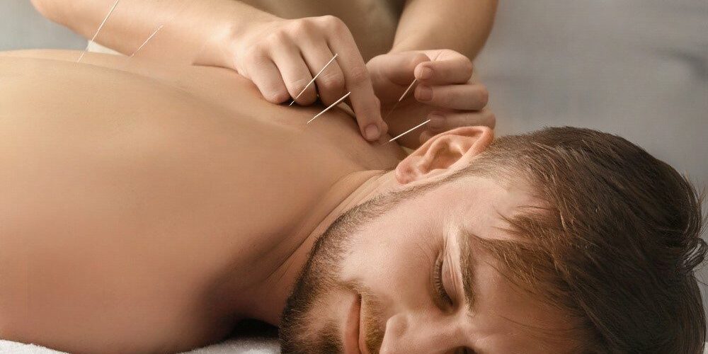Get Motor Point Acupuncture In San Francisco