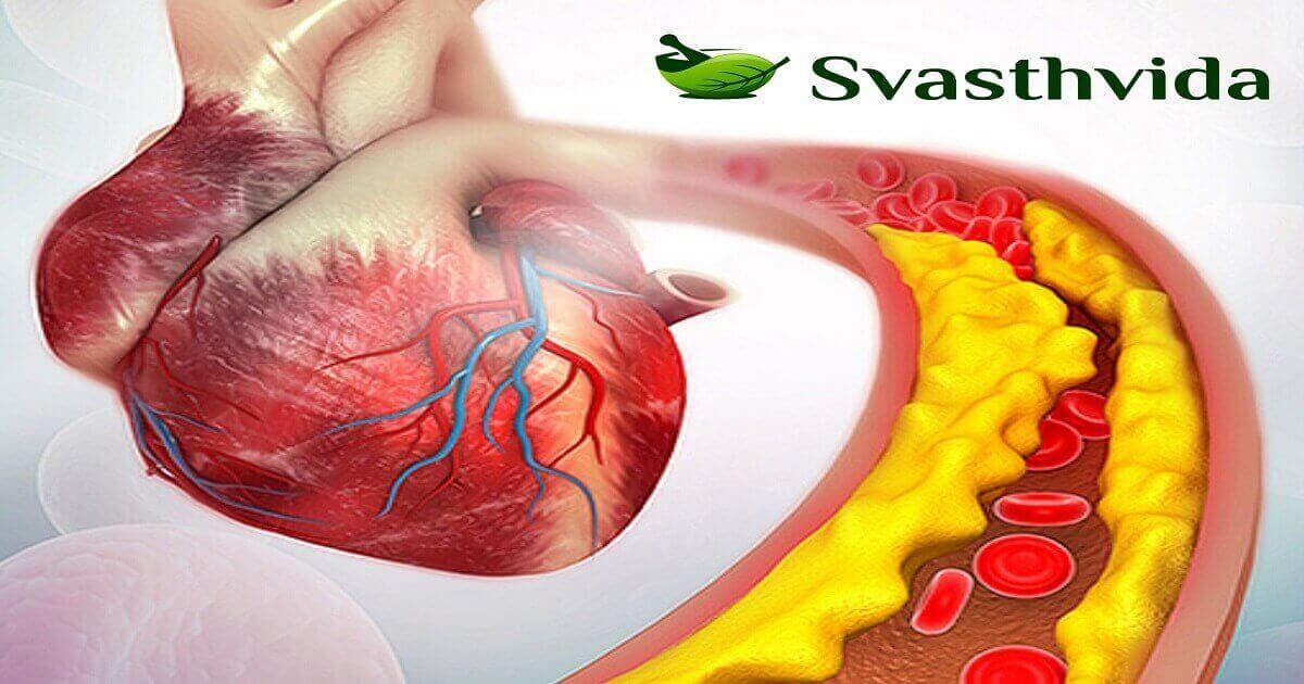 Ayurvedic Atherosclerosis Treatment In India