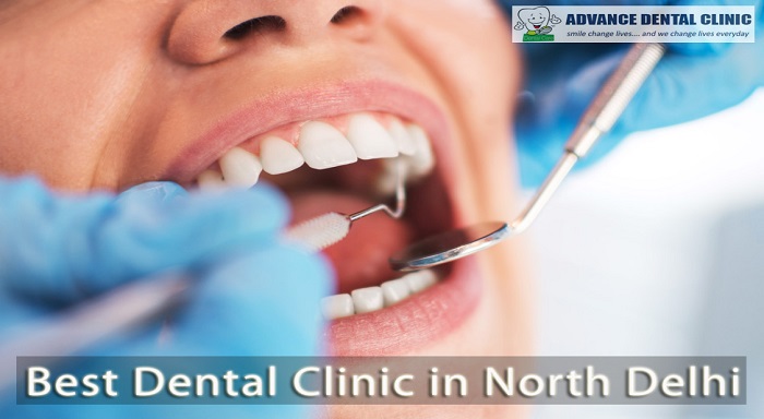 Best Dental Clinic In North Delhi | Advance Dental Clinic