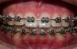 Professional Orthodontist Specialist In Berwick - Woodleigh Waters Dental Surgery