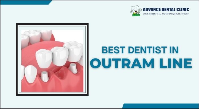 Dentist In Outram Lane