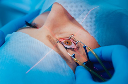 Transform Your Vision With Eye Laser Lasik At Harley Vision Laser Eye Clinic