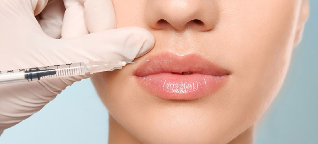 Dermal Fillers Cost In Richmond | Bio-International Laser Clinic