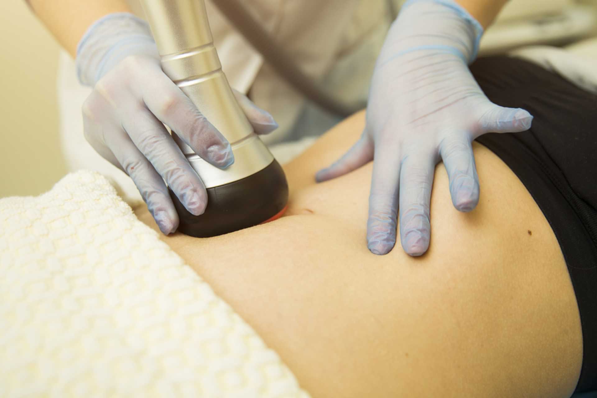 Stomach Laser Hair Removal In Delhi