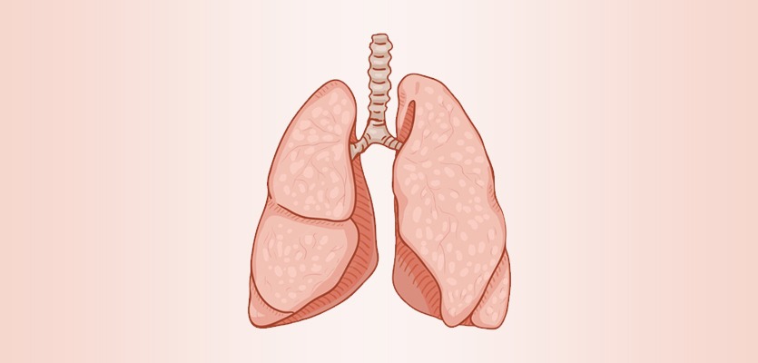 Lung Transplant In India - Dr. Arvind Kumar
