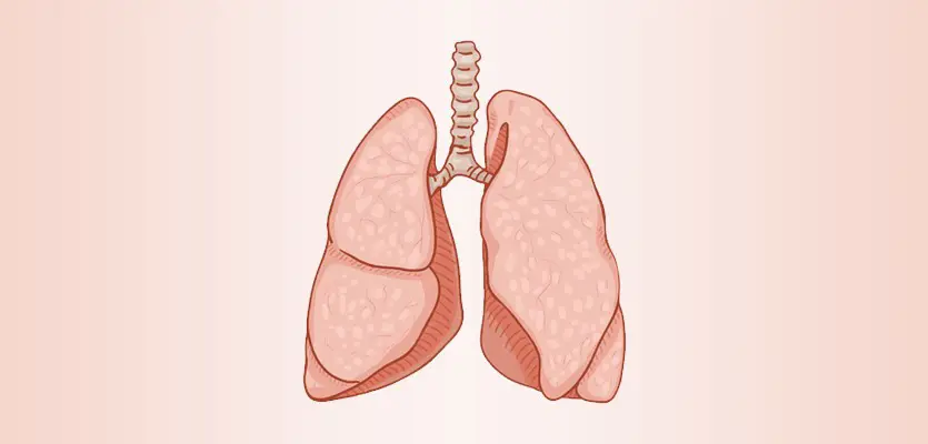 Lung Transplant Cost In Delhi
